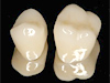 クローバー歯科東大島の審美治療