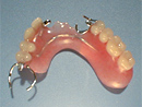 クローバー歯科東大島の入れ歯治療