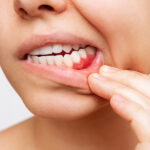 東大島（江東区）の歯医者、クローバー歯科東大島で歯ぐきが腫れているのに痛くないときの原因について解説