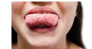 東大島（江東区）の歯医者、クローバー歯科東大島で舌の色や形で分かる口腔内の健康状態を解説