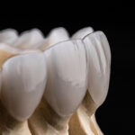 東大島（江東区）の歯医者、クローバー歯科東大島でセラミック矯正のメリットとリスクは？治療方法や歯への影響を解説